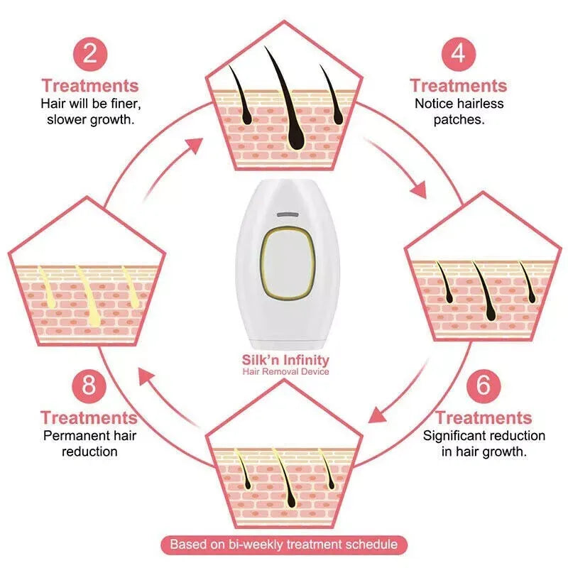 Illustration of GlowSilk IPL Hair Removal with treatment schedule on a white background