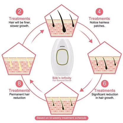 Illustration of GlowSilk IPL Hair Removal with treatment schedule on a white background